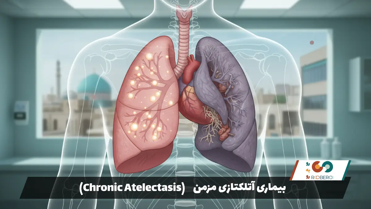 بیماری آتلکتازی مزمن (Chronic Atelectasis)