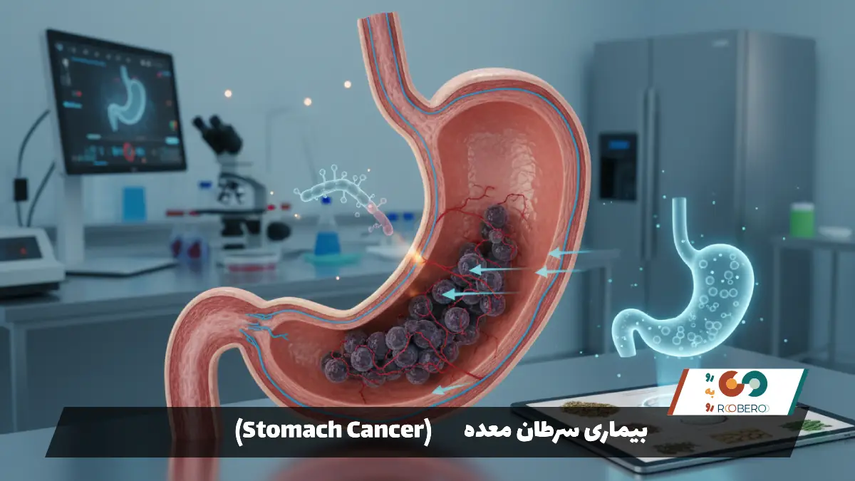 بیماری سرطان معده (Stomach Cancer)