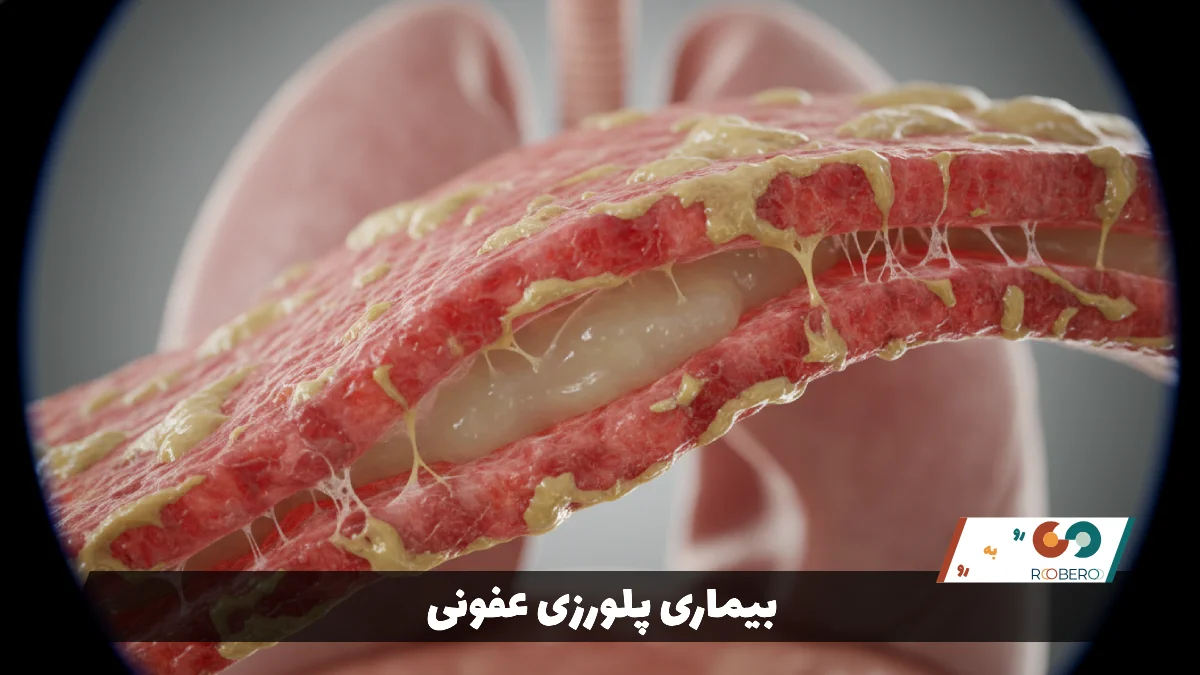 بیماری پلورزی عفونی (Infectious Pleurisy)