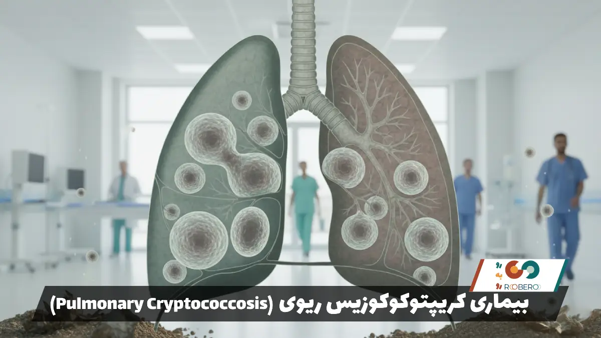 بیماری کریپتوکوکوزیس ریوی (Pulmonary Cryptococcosis)