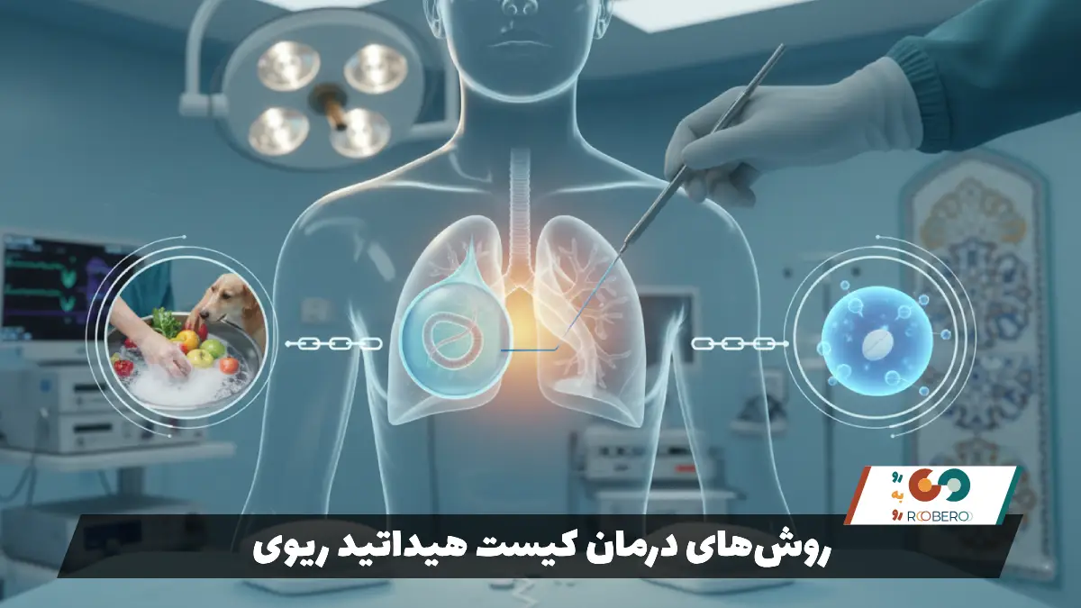 روش‌های درمان کیست هیداتید ریوی