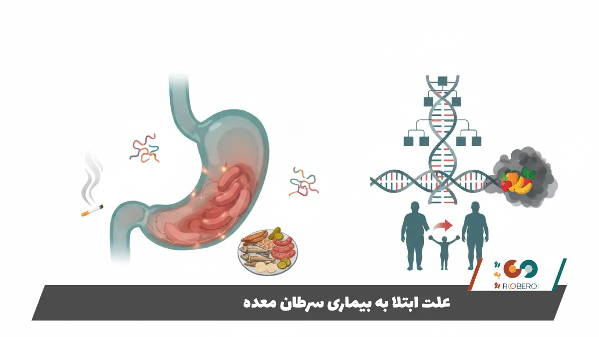 علت ابتلا به بیماری سرطان معده