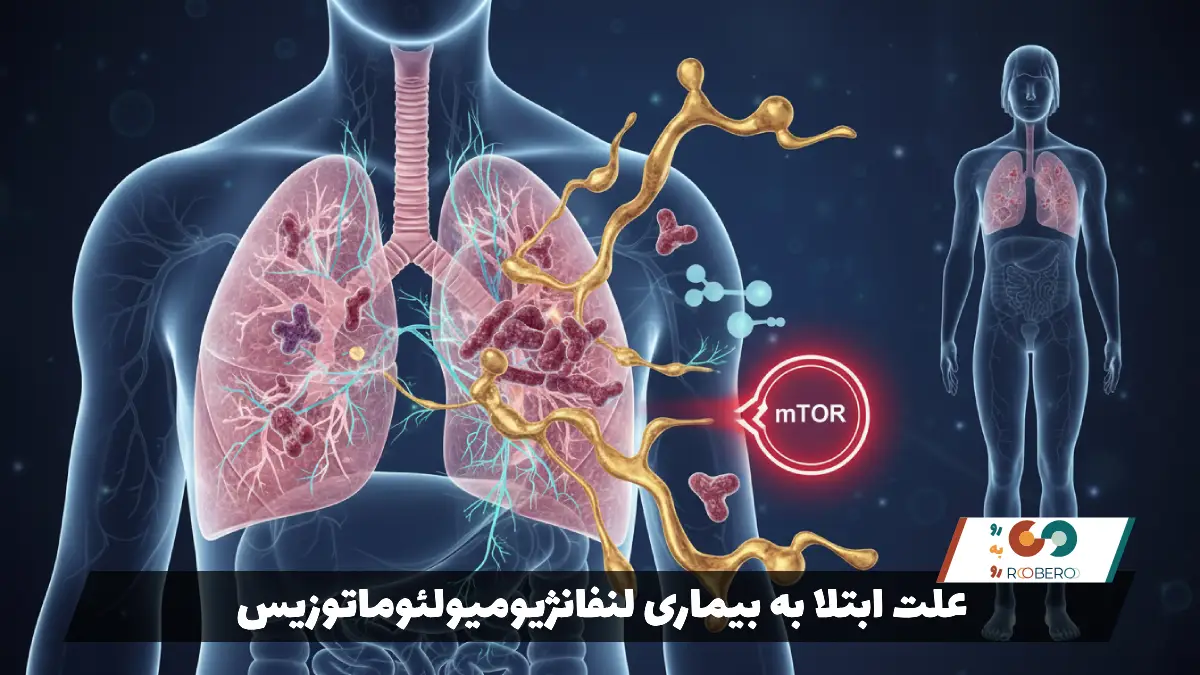 علت ابتلا به بیماری لنفانژیومیولئوماتوزیس