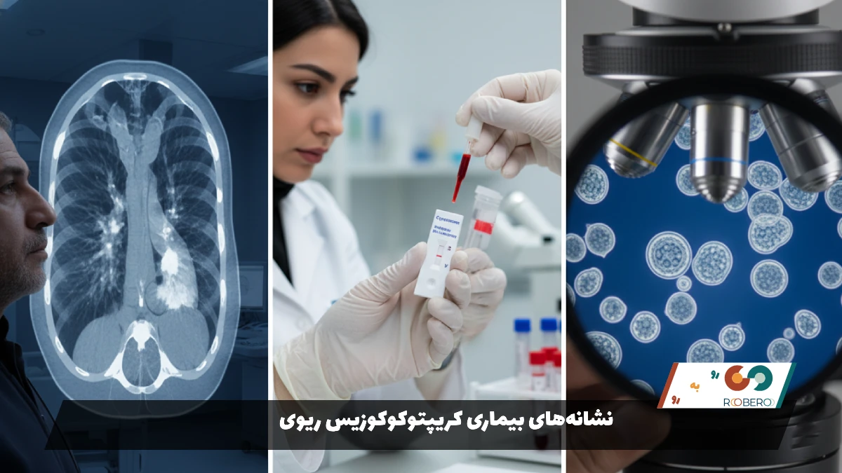 نشانههای بیماری کریپتوکوکوزیس ریوی