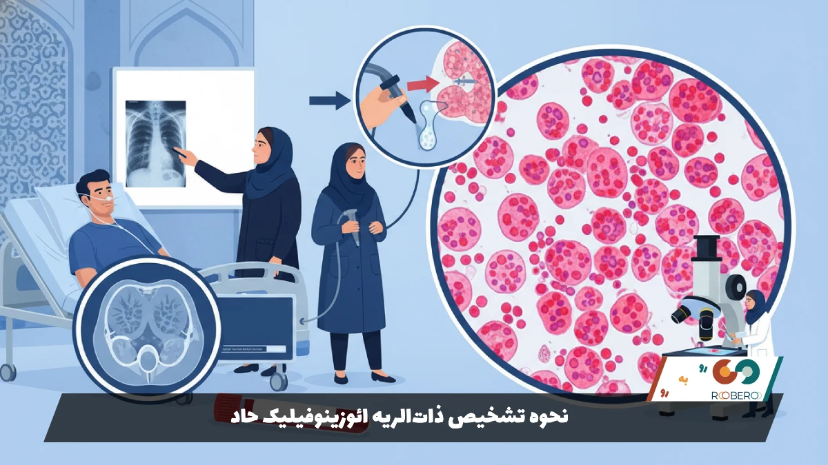 نحوه تشخیص ذات‌الریه ائوزینوفیلیک حاد