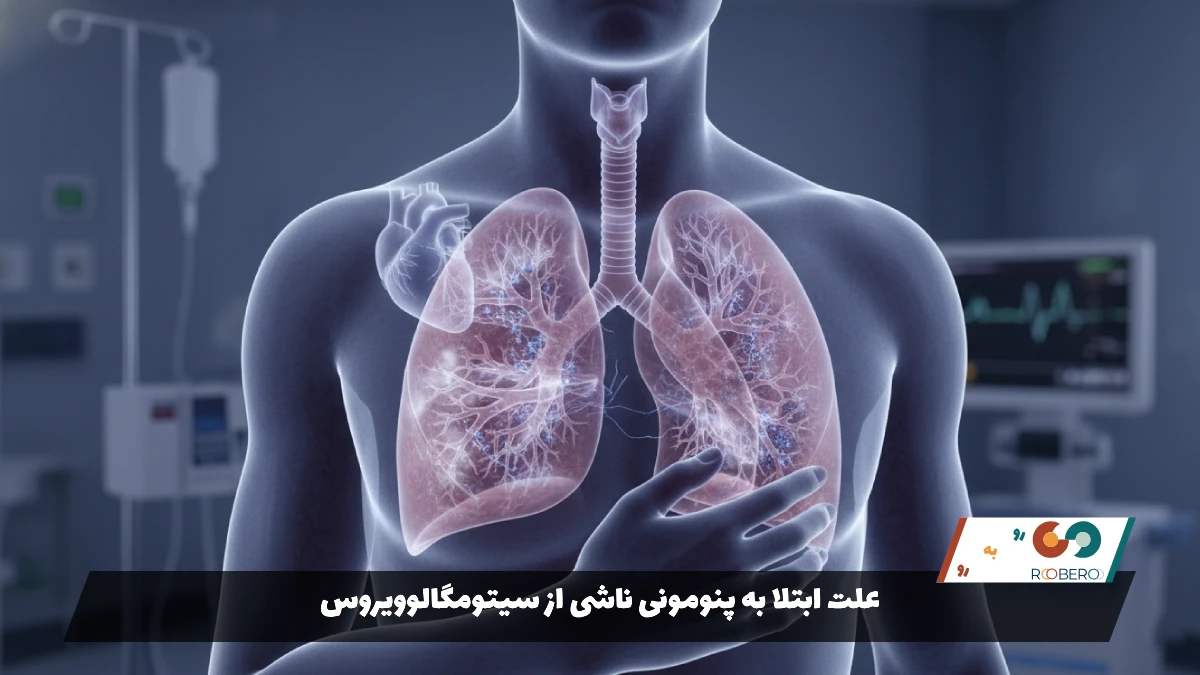 بیماری پنومونی ناشی از سیتومگالوویروس (CMV Pneumonia)
