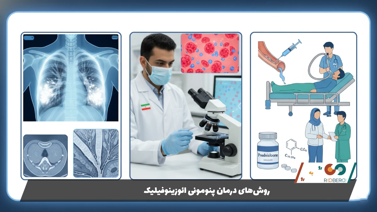 روشهای درمان پنومونی ائوزینوفیلیک