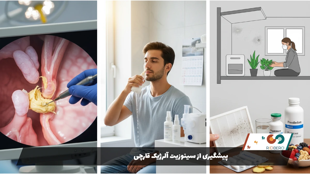 پیشگیری از سینوزیت آلرژیک قارچی