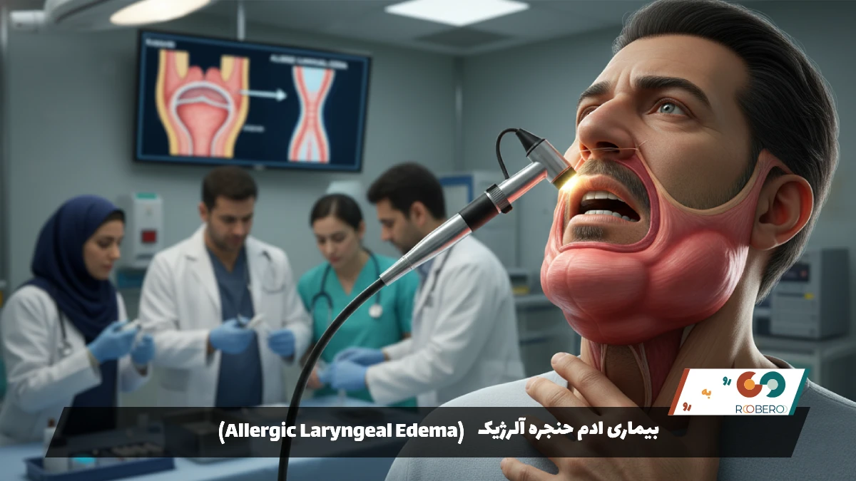 بیماری ادم حنجره آلرژیک (Allergic Laryngeal Edema)