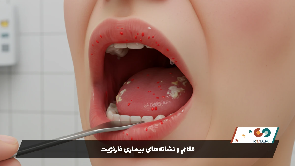 علائم و نشانههای بیماری فارنژیت