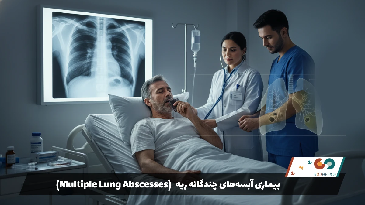 بیماری آبسه‌های چندگانه ریه (Multiple Lung Abscesses)