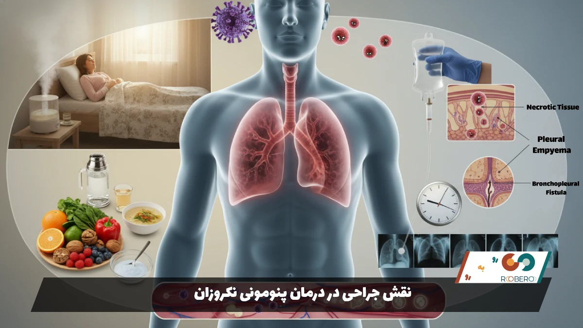 نقش جراحی در درمان پنومونی نکروزان