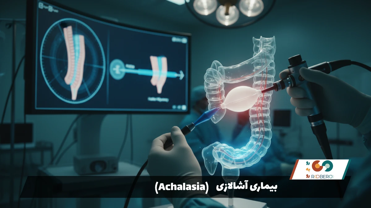 بیماری آشالازی (Achalasia)