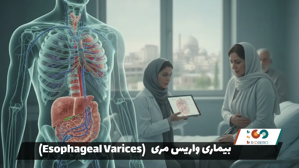 بیماری واریس مری (Esophageal Varices)