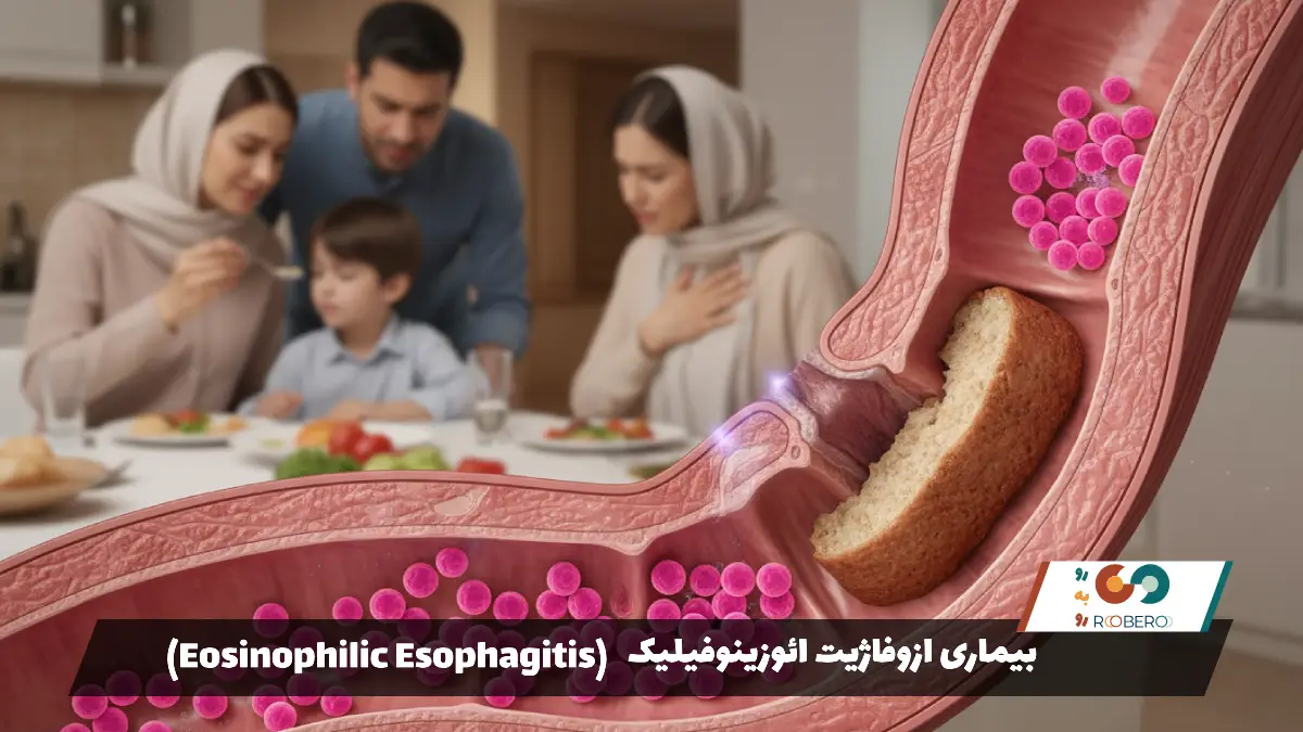 بیماری ازوفاژیت ائوزینوفیلیک (Eosinophilic Esophagitis)