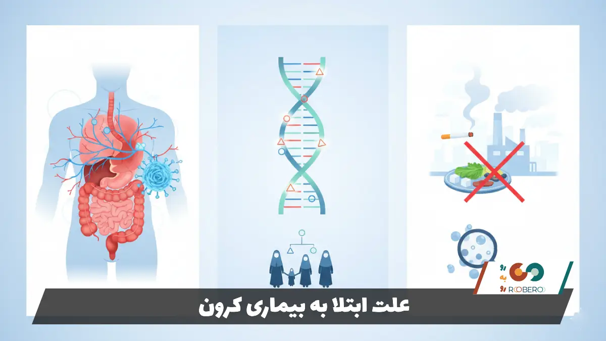 علت ابتلا به بیماری کرون
