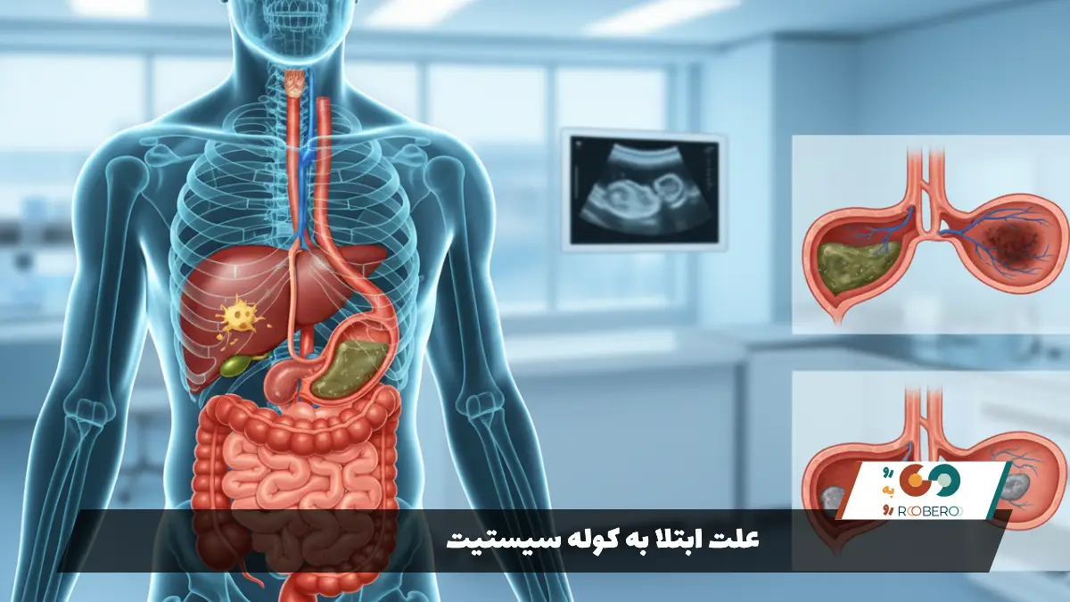 علت ابتلا به کوله سیستیت