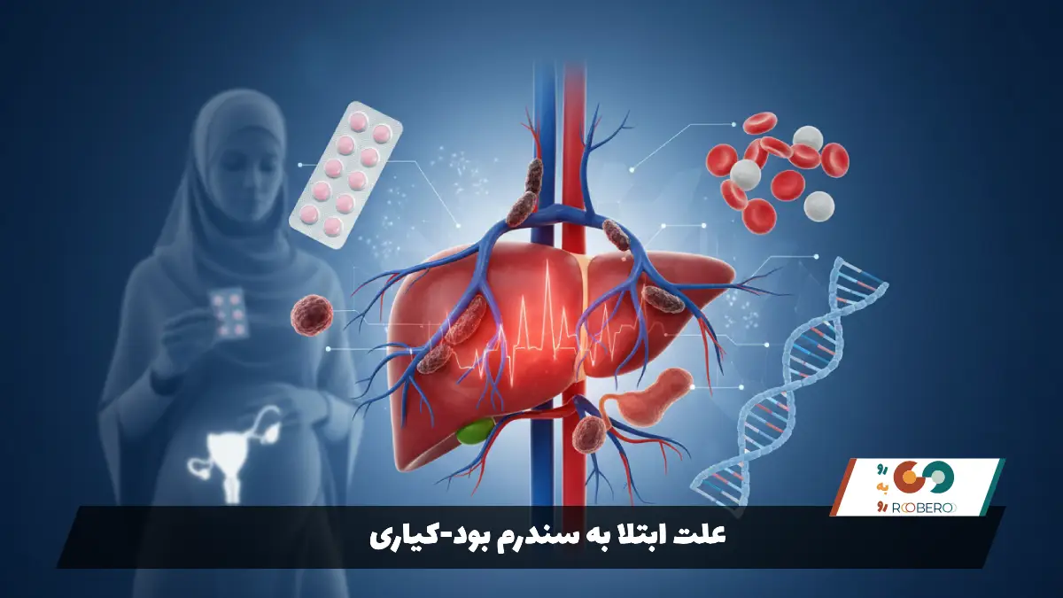 علت ابتلا به سندرم بود-کیاری