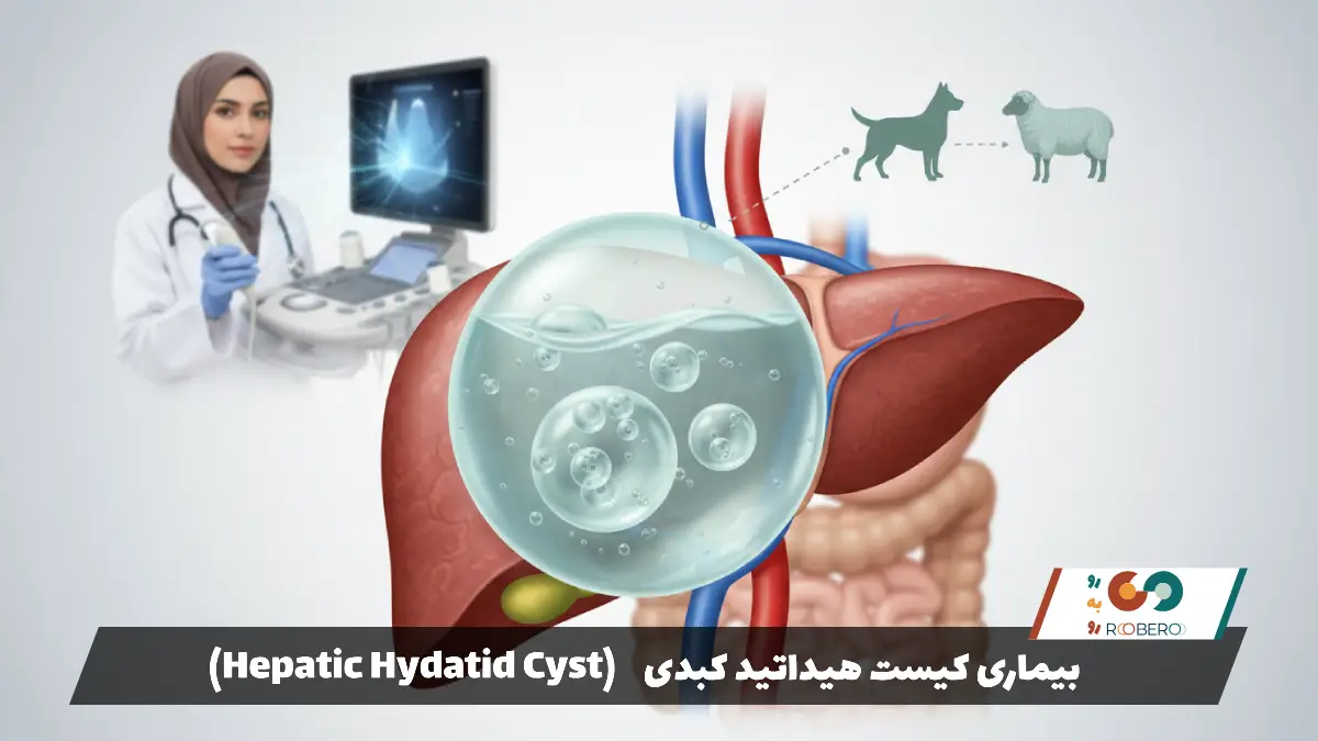 بیماری کیست هیداتید کبدی (Hepatic Hydatid Cyst)