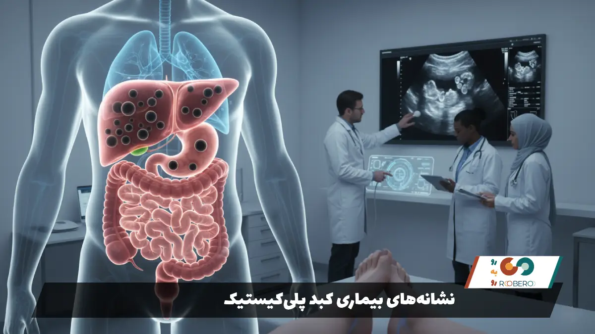 نشانههای بیماری کبد پلیکیستیک