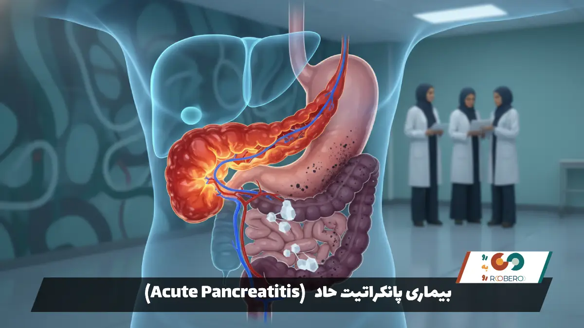 بیماری پانکراتیت حاد (Acute Pancreatitis)