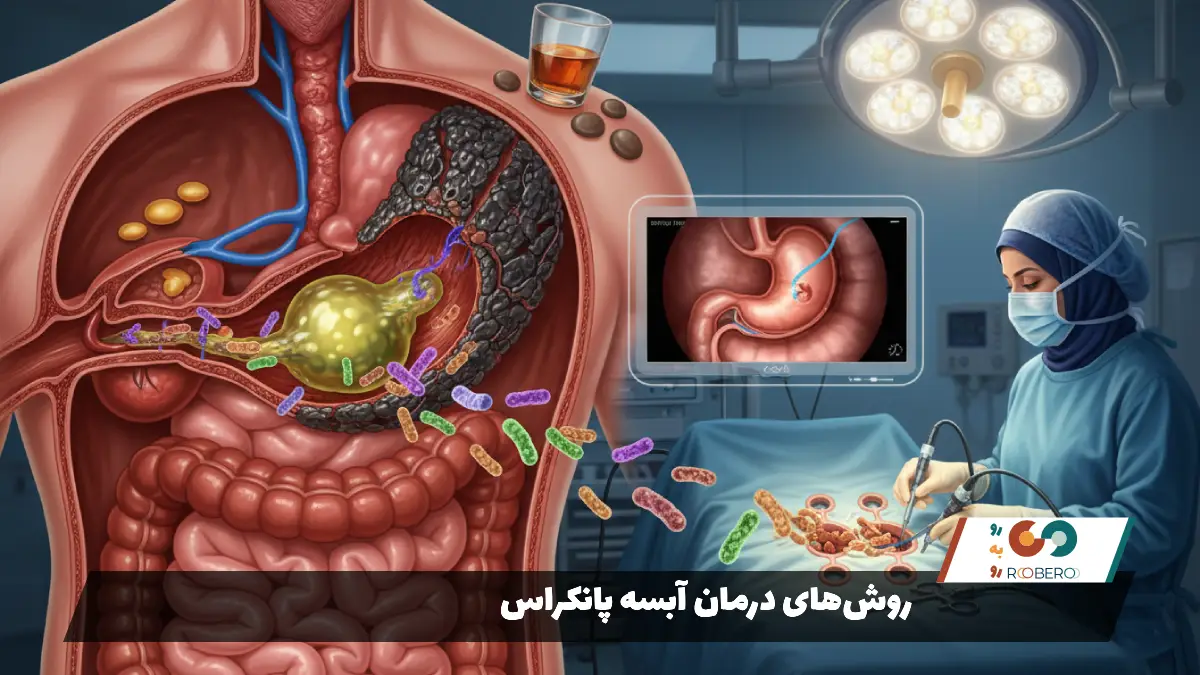 روشهای درمان آبسه پانکراس