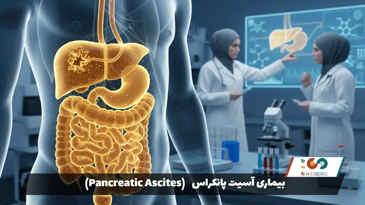 بیماری آسیت پانکراس (Pancreatic Ascites)