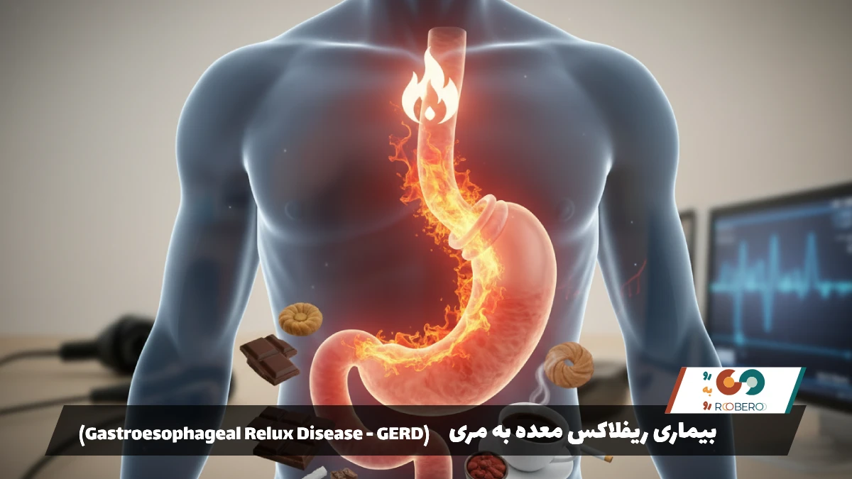 بیماری ریفلاکس معده به مری (Gastroesophageal Reflux Disease – GERD)