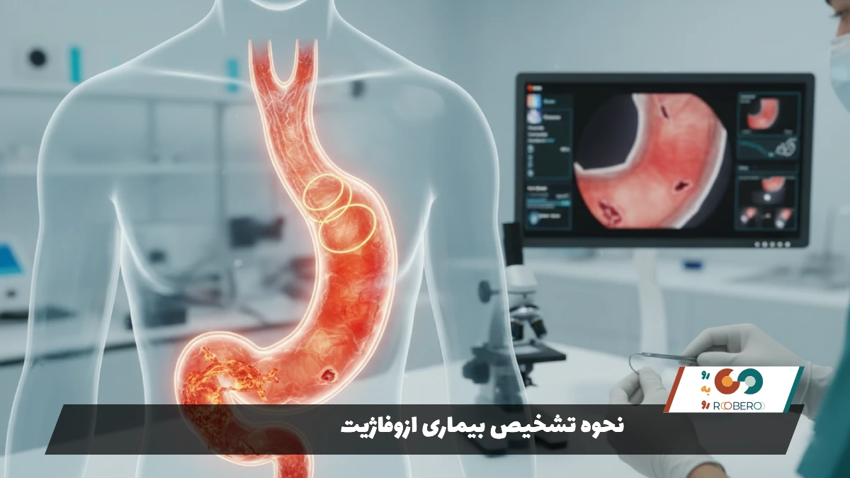 نحوه تشخیص بیماری ازوفاژیت