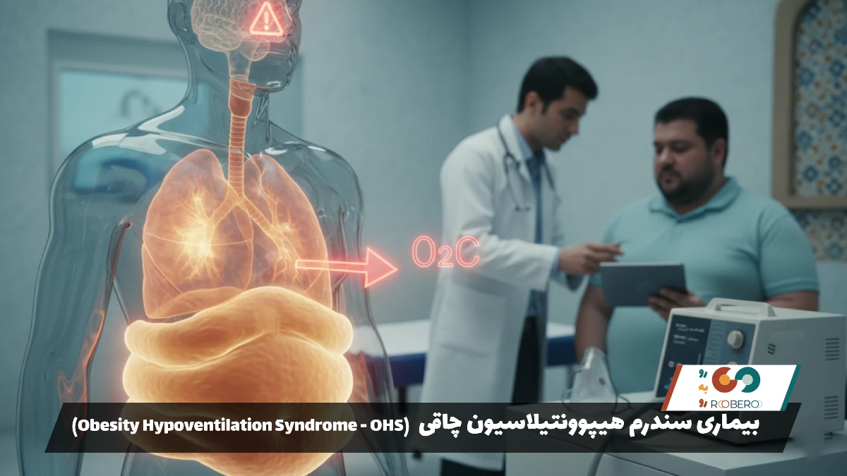 بیماری سندرم هیپوونتیلاسیون چاقی (Obesity Hypoventilation Syndrome – OHS)