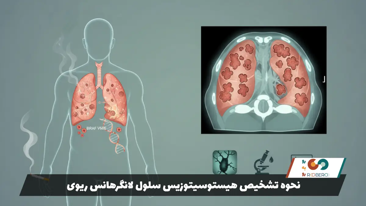 نحوه تشخیص هیستوسیتوزیس سلول لانگرهانس ریوی