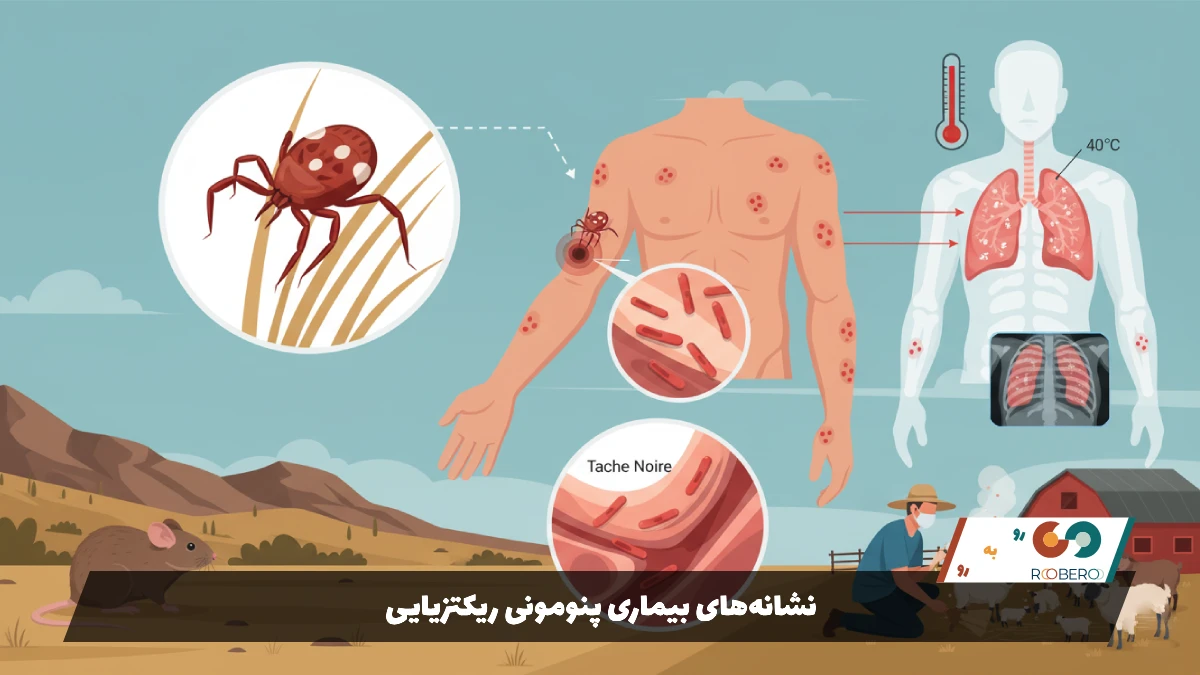 نشانه‌های بیماری پنومونی ریکتزیایی