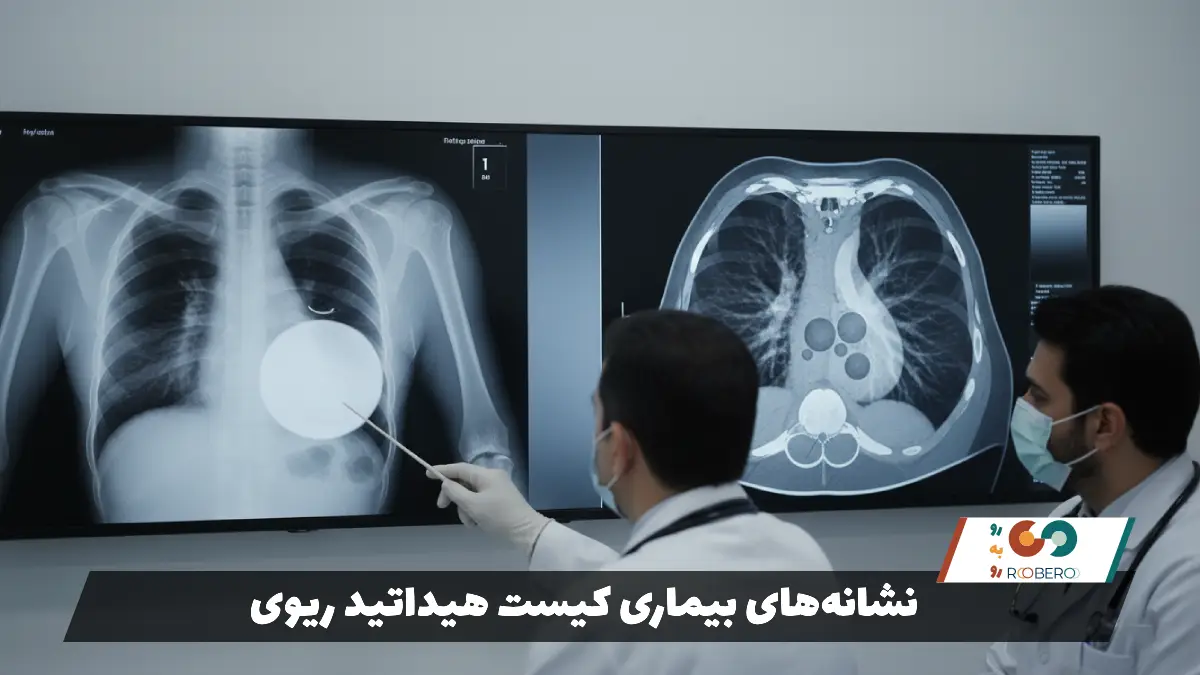 نشانه‌های بیماری کیست هیداتید ریوی