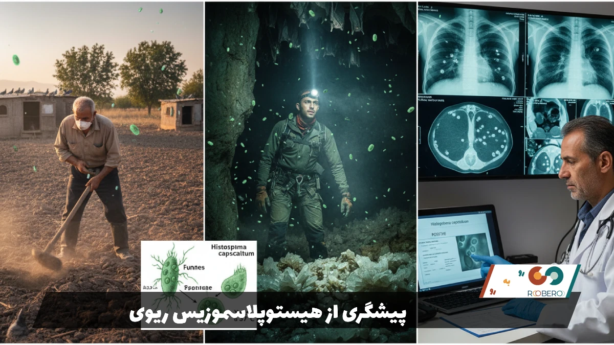 پیشگری از هیستوپلاسموزیس ریوی