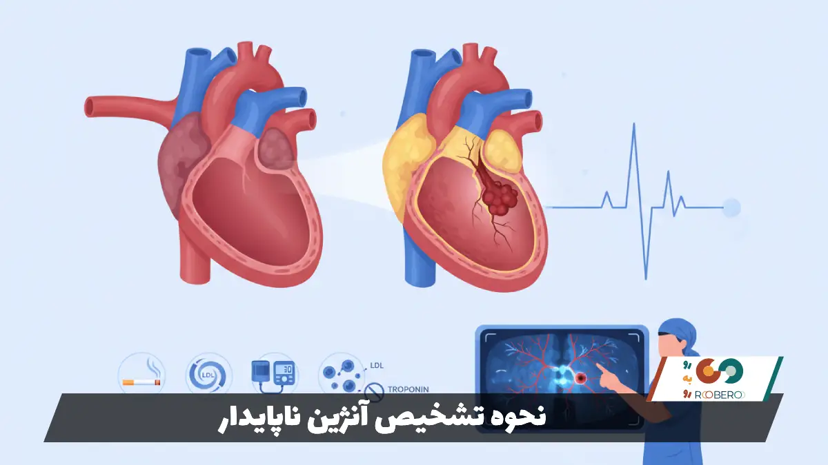 نحوه تشخیص آنژین ناپایدار