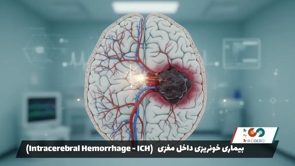 بیماری خونریزی داخل مغزی (Intracerebral Hemorrhage – ICH)