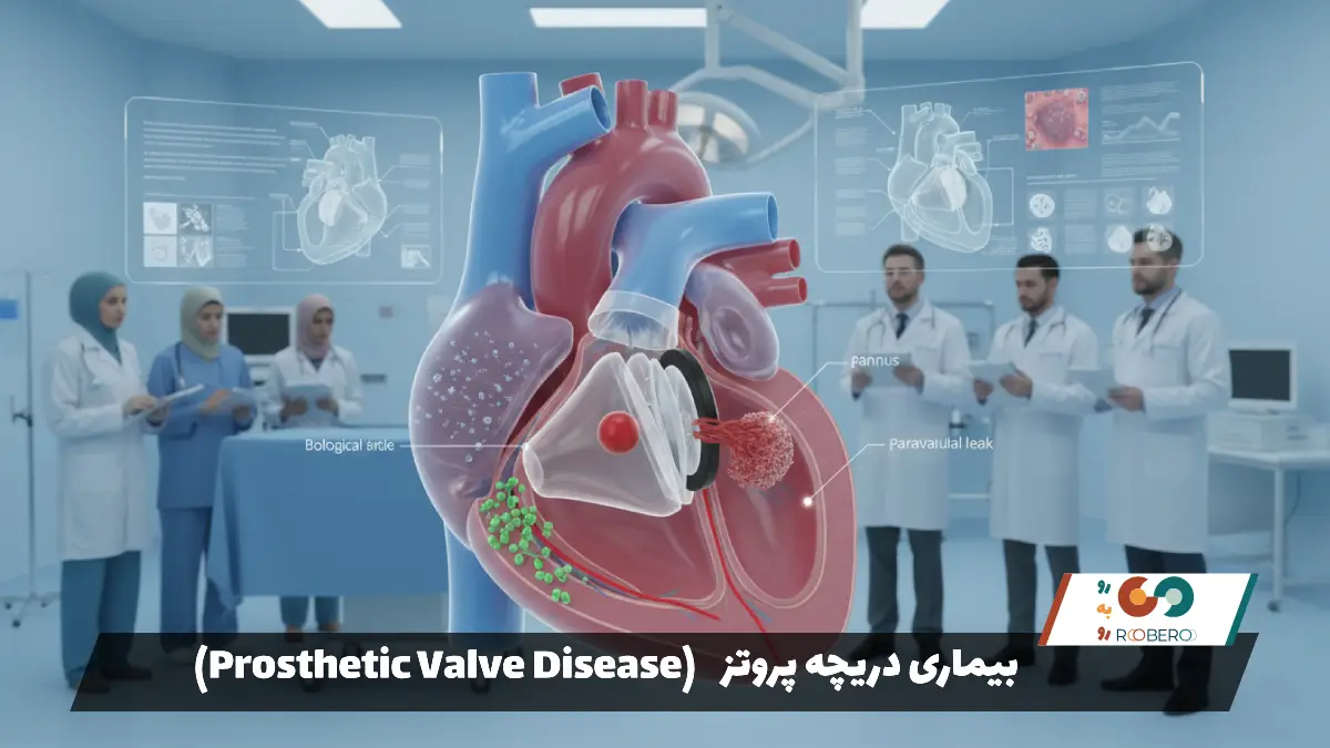 بیماری دریچه پروتز (Prosthetic Valve Disease)