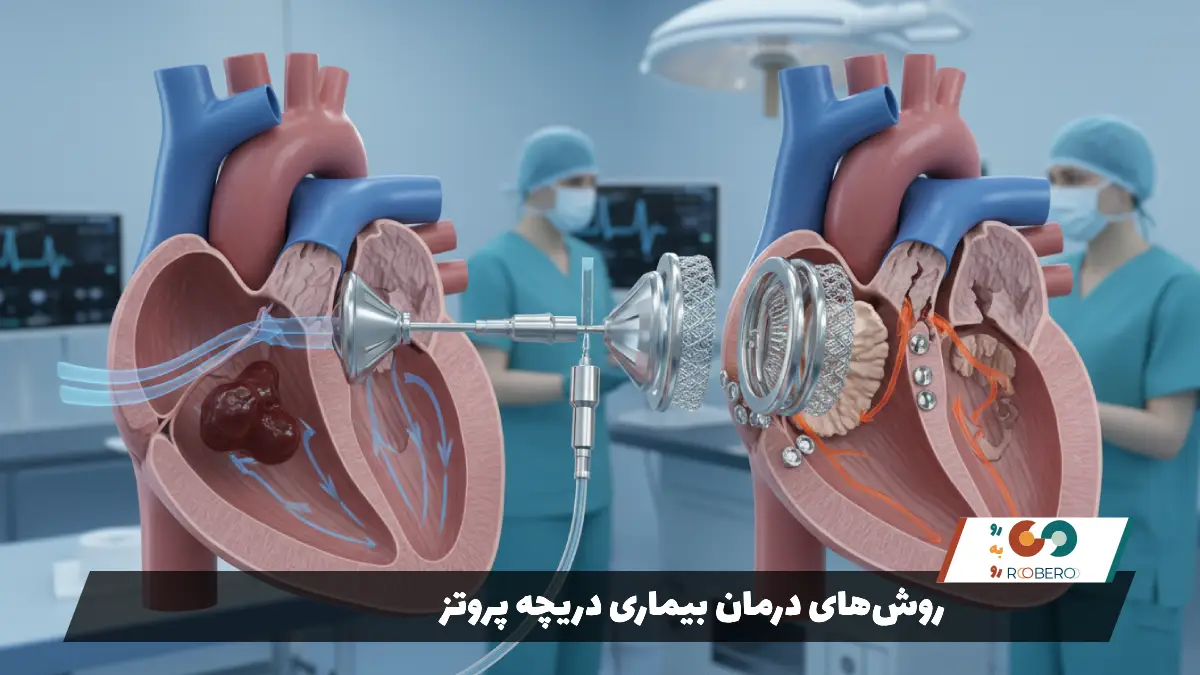 روش‌های درمان بیماری دریچه پروتز
