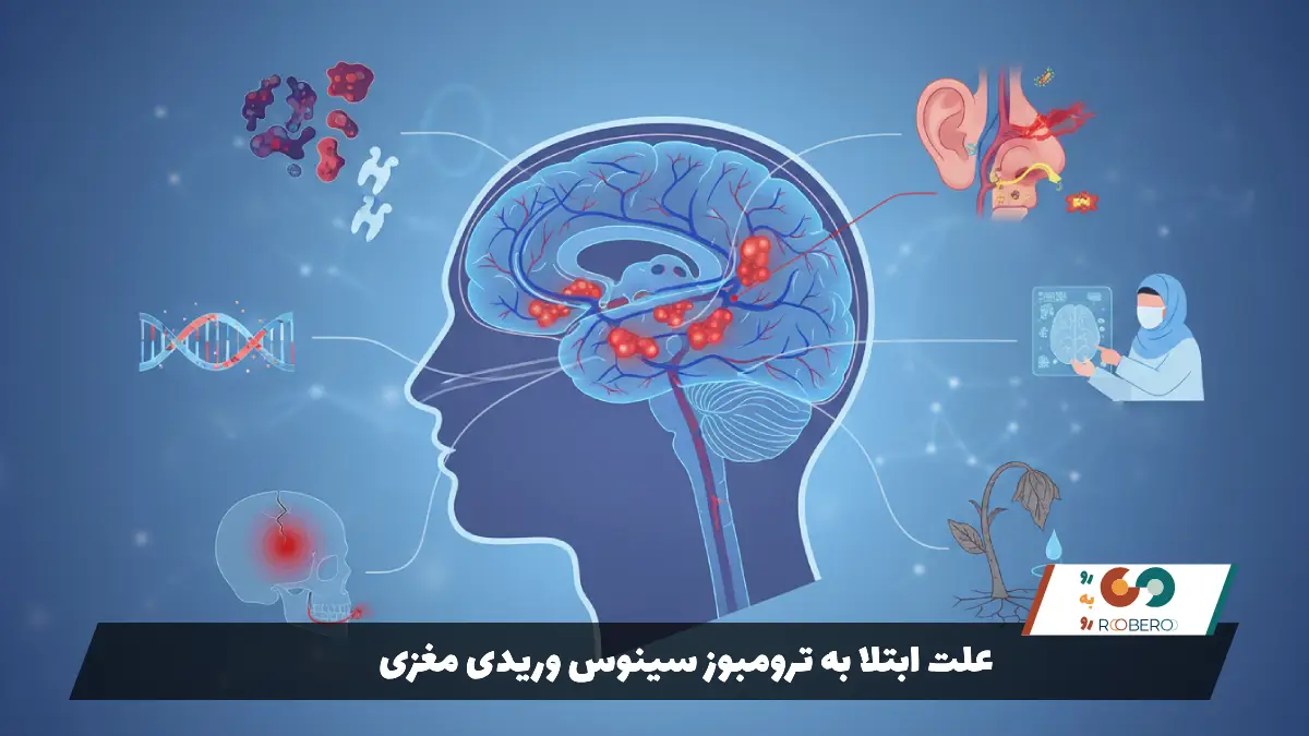 علت ابتلا به ترومبوز سینوس وریدی مغزی