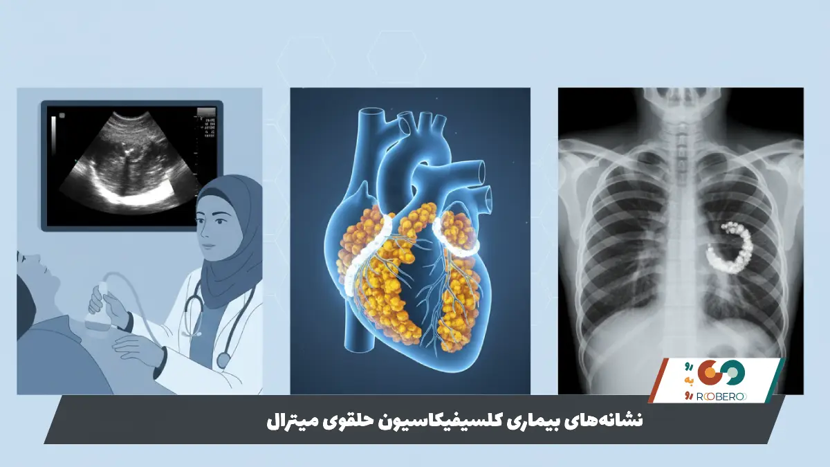 نشانه‌های بیماری کلسیفیکاسیون حلقوی میترال