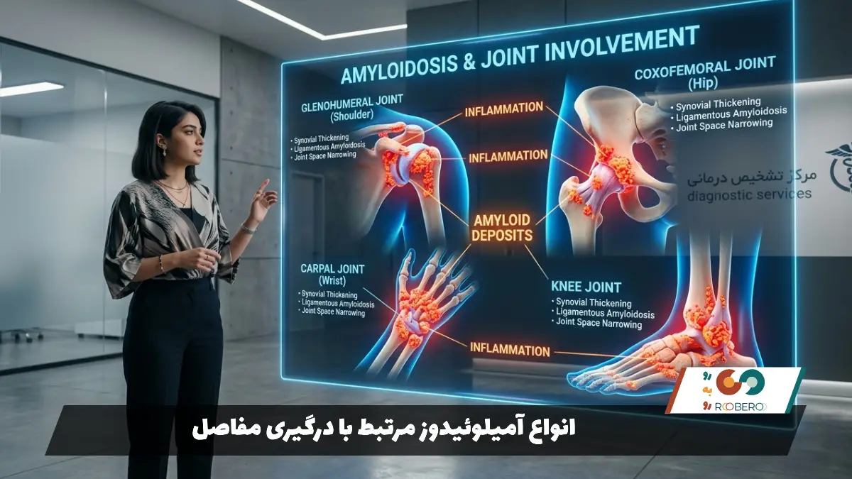 انواع آمیلوئیدوز مرتبط با درگیری مفاصل