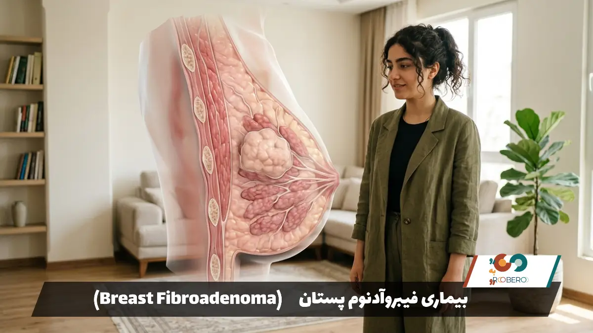 بیماری فیبروآدنوم پستان (Breast Fibroadenoma)