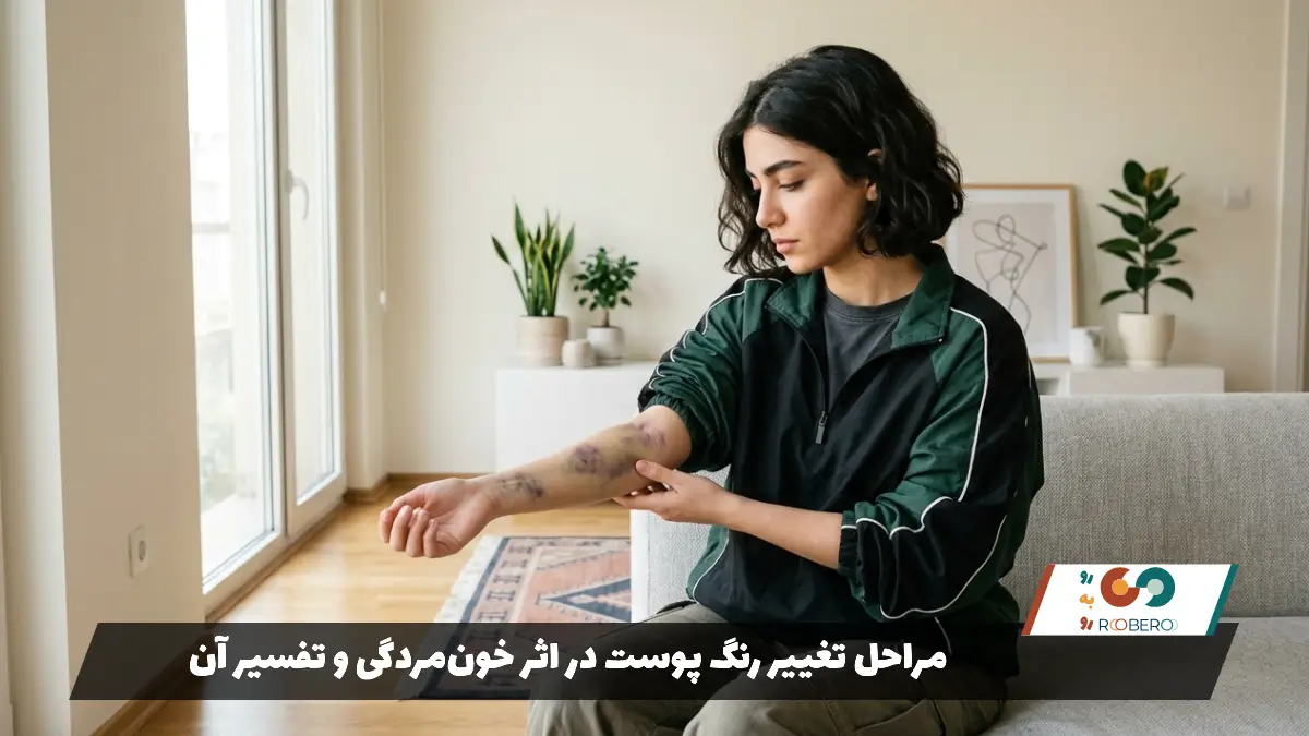 مراحل تغییر رنگ پوست در اثر خون‌مردگی و تفسیر آن