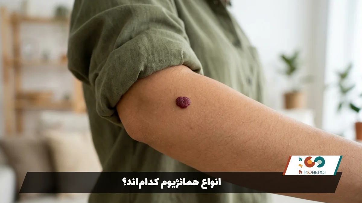 انواع همانژیوم کدام‌اند؟