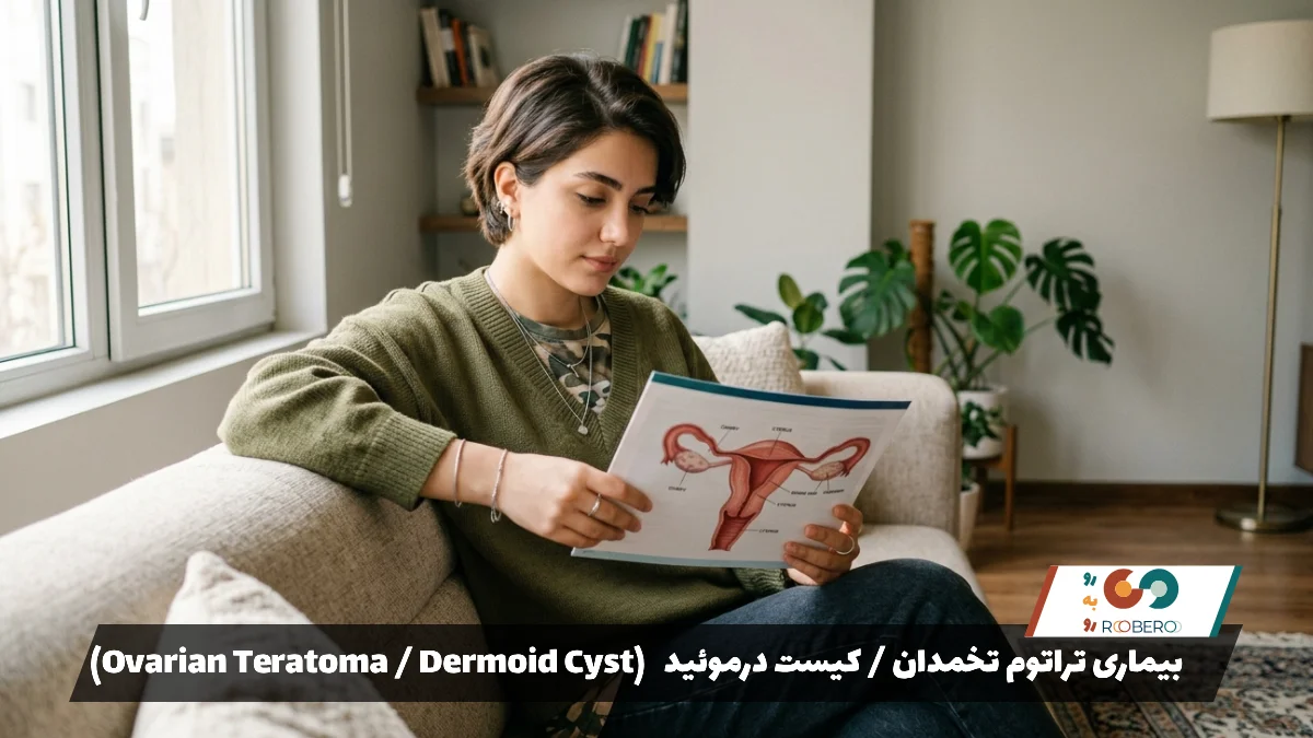بیماری تراتوم تخمدان / کیست درموئید (Ovarian Teratoma / Dermoid Cyst)