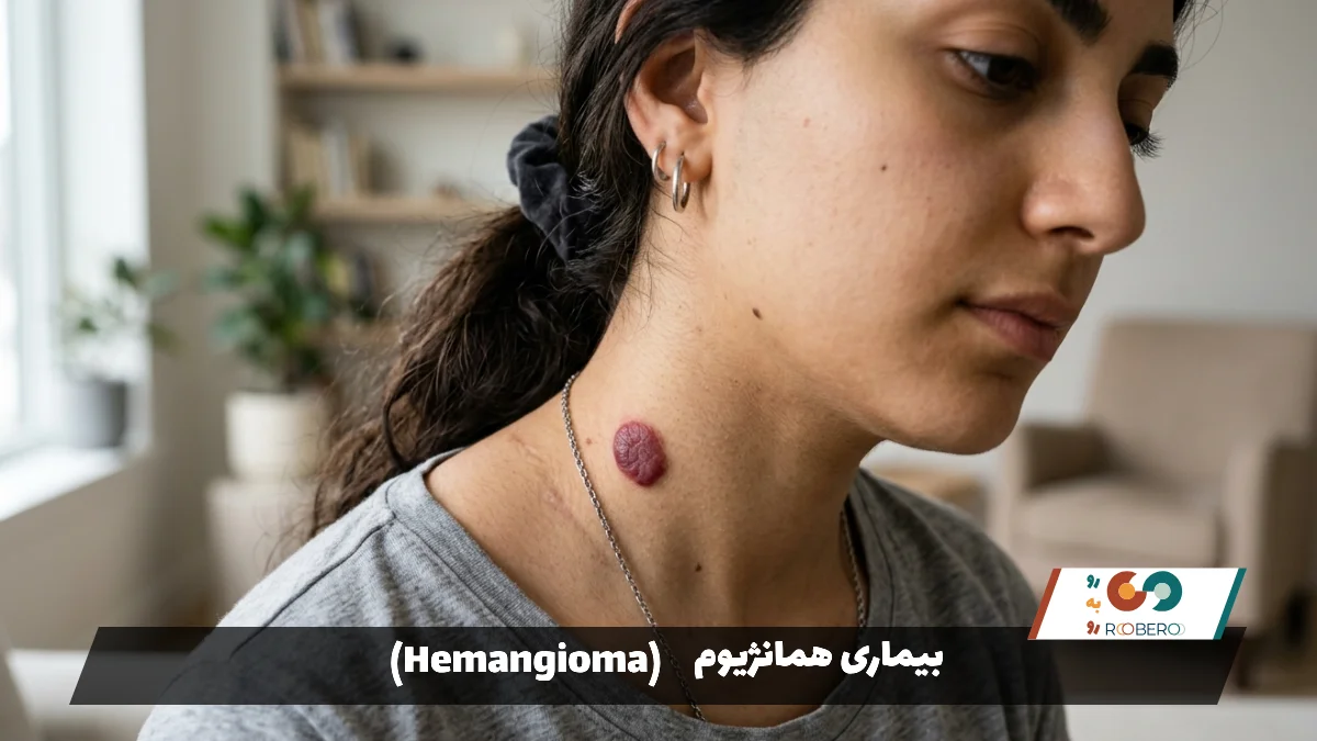 بیماری همانژیوم (Hemangioma)