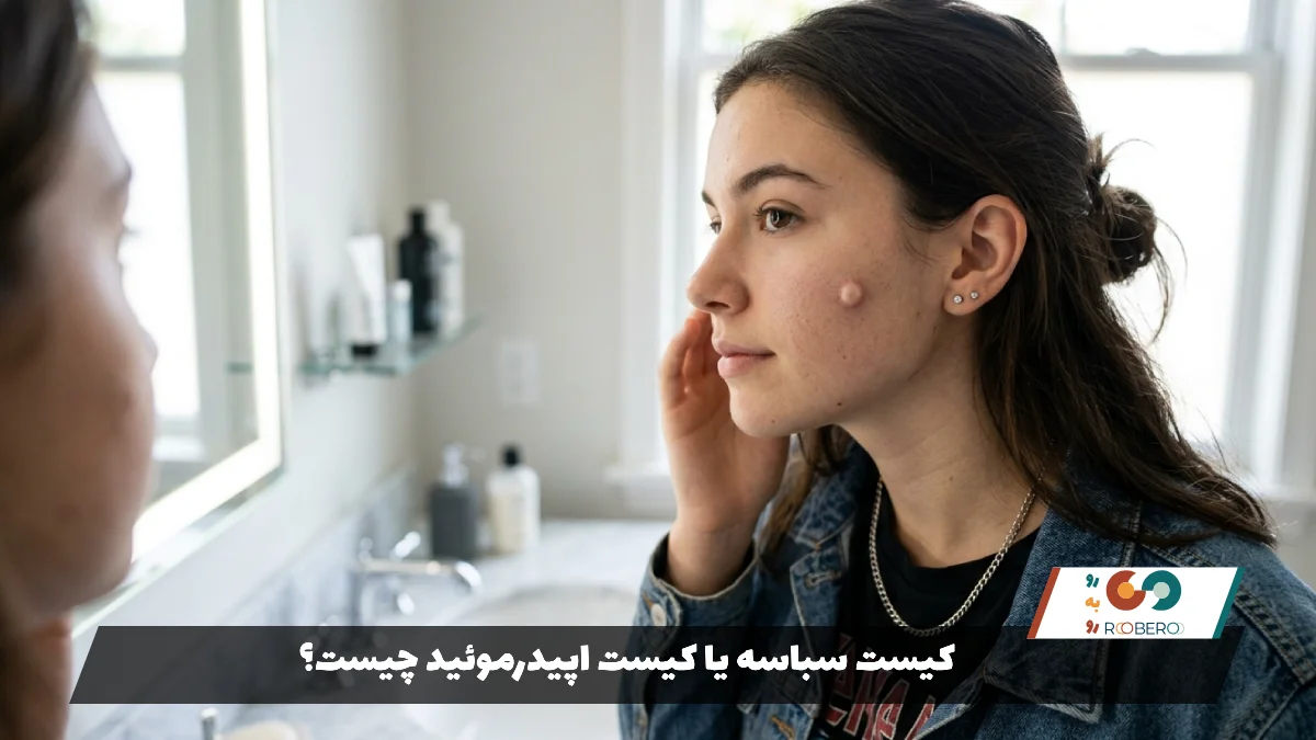 کیست سباسه یا کیست اپیدرموئید چیست؟