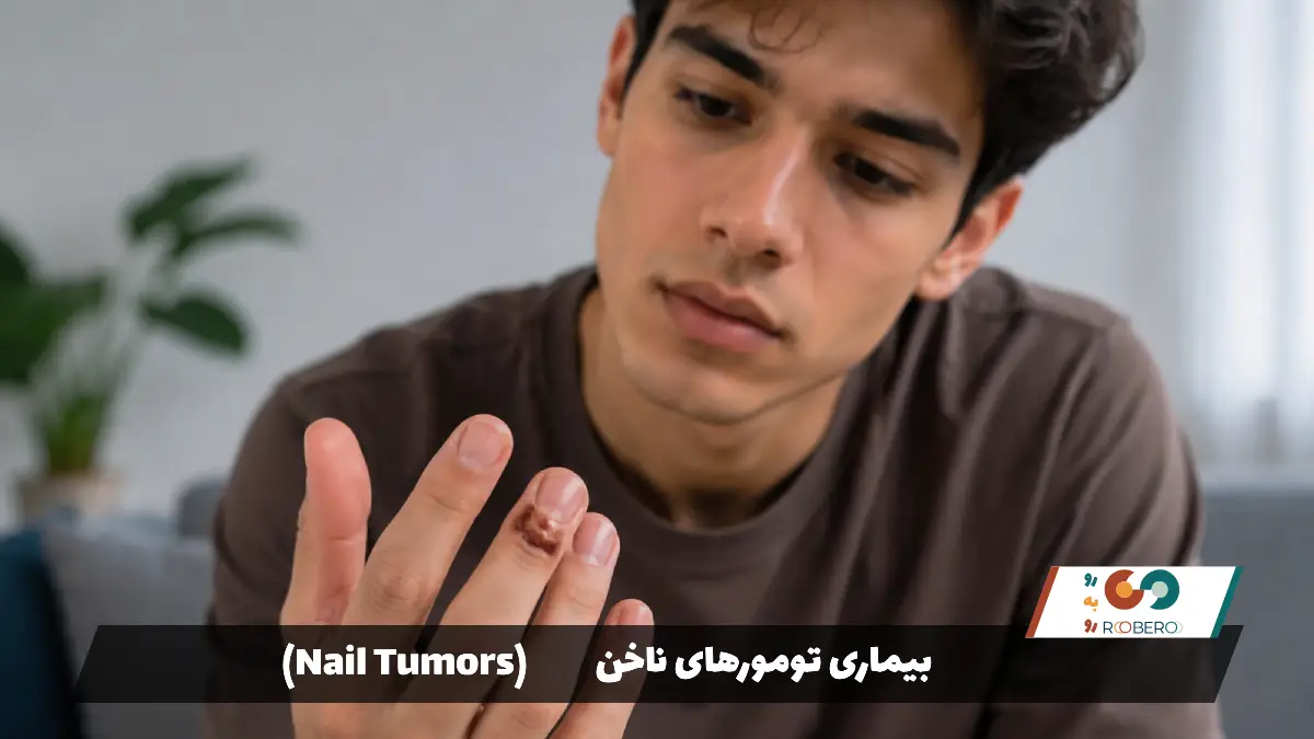بیماری تومورهای ناخن (Nail Tumors)