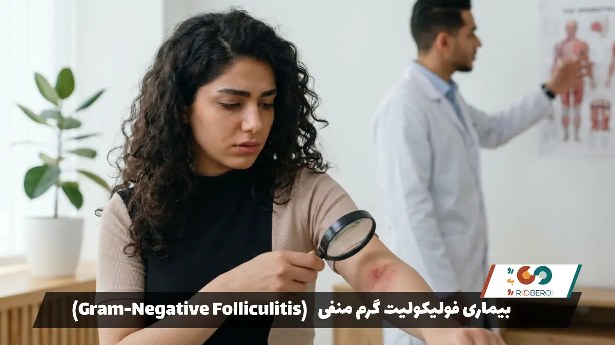 بیماری فولیکولیت گرم منفی (Gram-Negative Folliculitis)