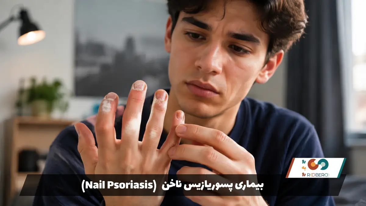 بیماری پسوریازیس ناخن (Nail Psoriasis)